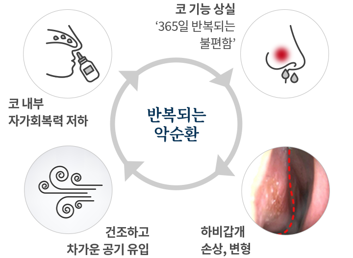 알레르기비염 qna mo 이미지