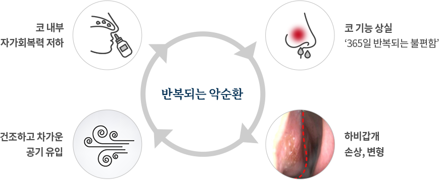 알레르기비염 qna pc 이미지