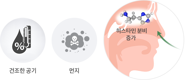 노인성비염 cause 이미지