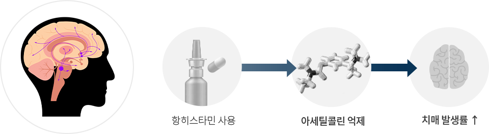 노인성비염 qna 이미지