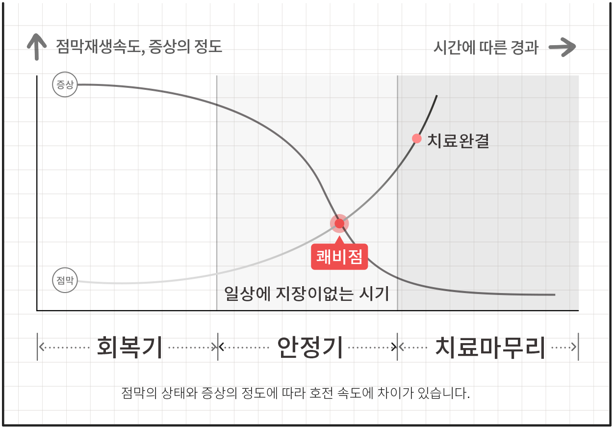 쾌비치료 점막재생속도 이미지