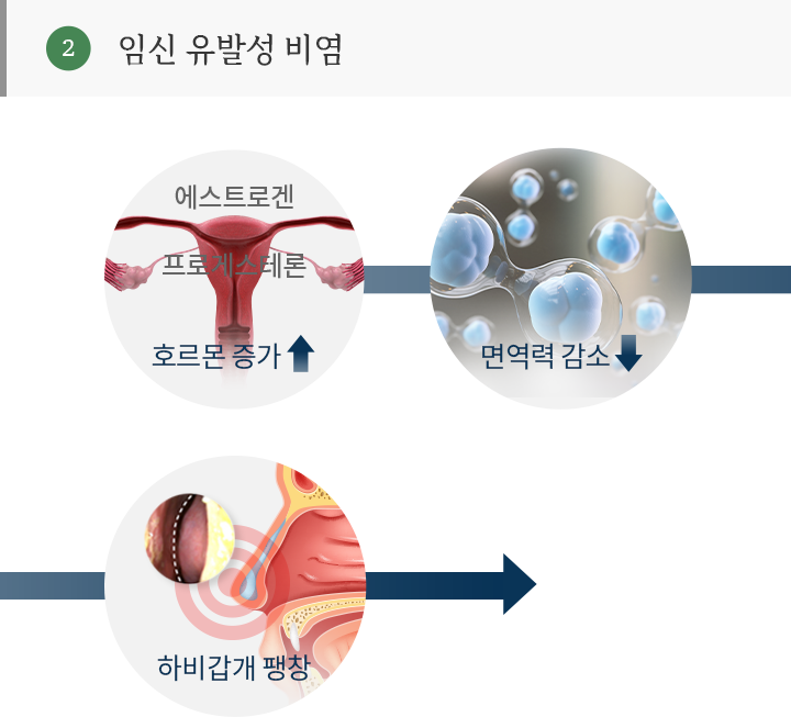 임산부비염 cause mo 이미지